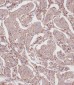 RPL23A Antibody (C-term)